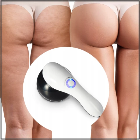 PISTOLET DO MASAŻU MASAŻER ANTYCELLULITOWY WYSZCZUPLAJĄCY DO CELLULITU 9w1, Kolor dominujący biały